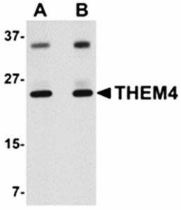 THEM4 Antibody