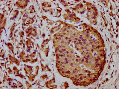 THEMIS2 antibody