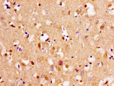 TPMT Antibody