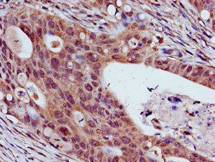 THOC3 Antibody