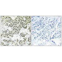 THOC5 Antibody