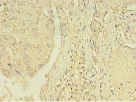 THRB Antibody