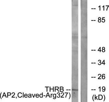 THRB (AP2, Cleaved-Arg327) Antibody