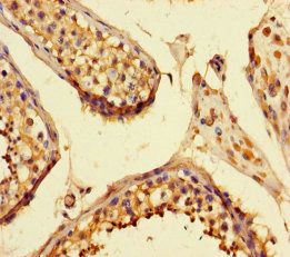 threonine-protein kinase 25 antibody