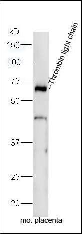 Thrombin light chain antibody