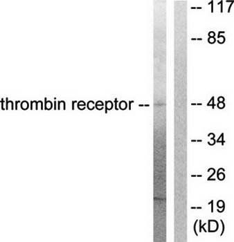 Thrombin Receptor antibody
