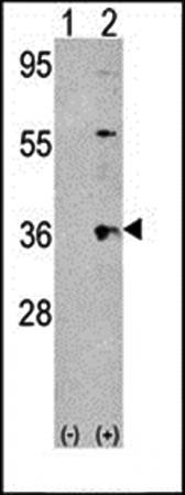 Thrombopoietin antibody
