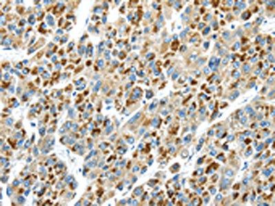 THBS2 Antibody