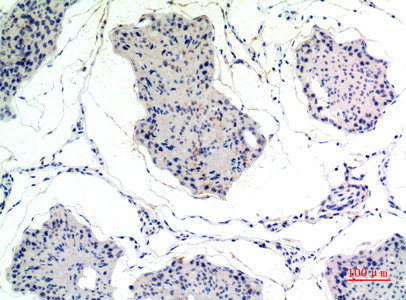 Thrombospondin 2 antibody