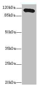 Thrombospondin-3 antibody