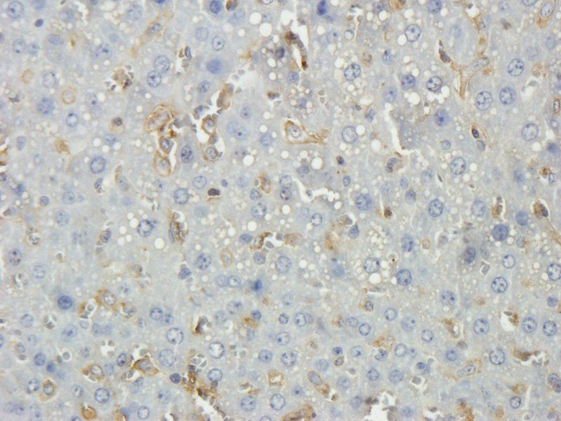 Thrombospondin 2 Rabbit Polyclonal Antibody