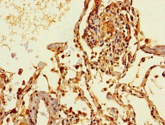 THRSP Antibody