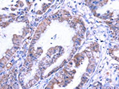 THRSP antibody