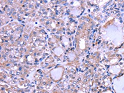 THRSP Antibody