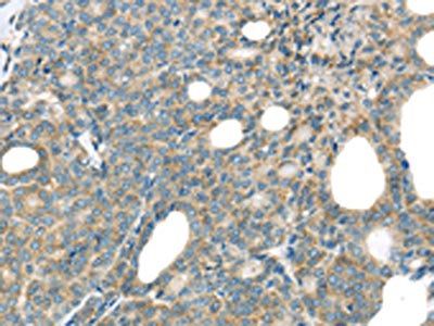 THSD1 Antibody