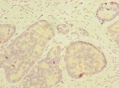 THTPA Antibody