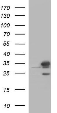 THUMPD1 antibody