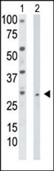 Thymidine Kinase 2 antibody