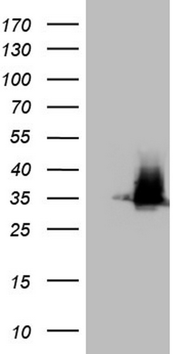 Thymidylate Synthase (TYMS) antibody