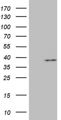 Thyroglobulin (TG) antibody