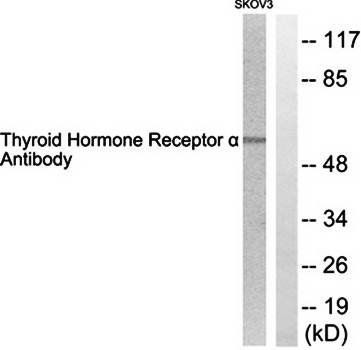 Thyroid Hormone Receptor alpha antibody