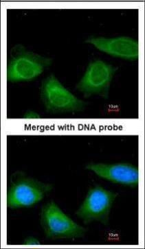 Thyroxine Binding Globulin Rabbit Polyclonal Antibody