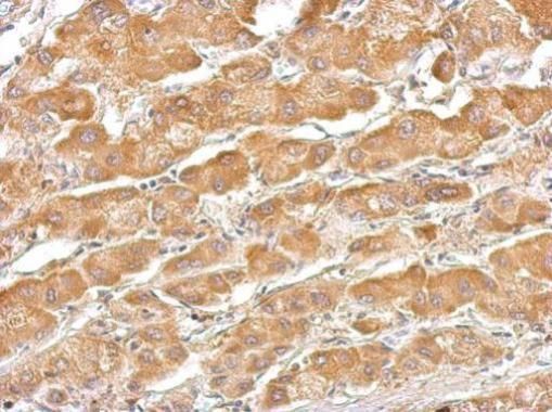 Thyroxine Binding Globulin Rabbit Polyclonal Antibody