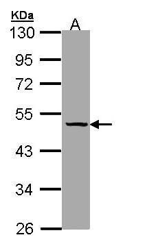 Thyroxine Binding Globulin Rabbit Polyclonal Antibody