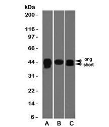 TIA-1 Antibody / T-Cell Intracellular Antigen-1