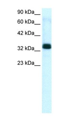 TIAL1 antibody