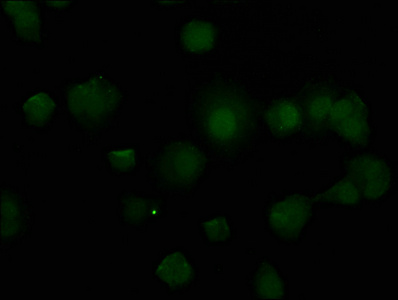 TIAL1 Antibody