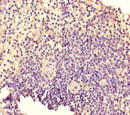 TIAM1 Antibody