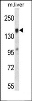 TIAM2 antibody