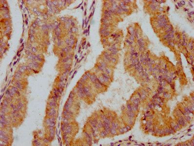 TIAM2 Antibody
