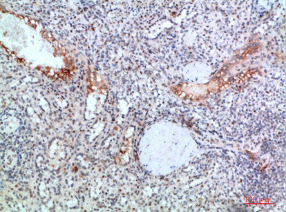 TICAM1 Antibody