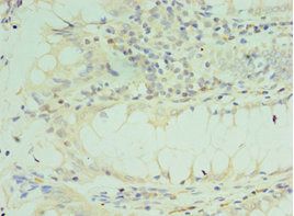 TICAM2 Antibody
