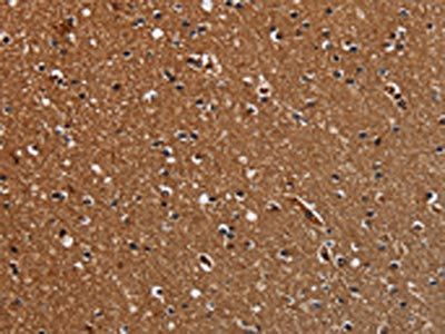 TICAM2 Antibody