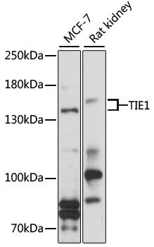 TIE1 antibody