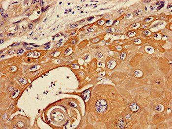 TIE1 Antibody