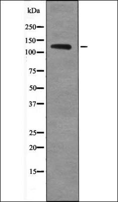 TIE2 (Phospho-Ser1119) antibody