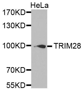 TIF1Beta antibody