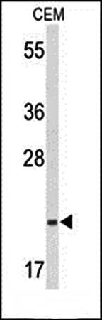 TIFA antibody