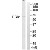 TIGD1 antibody