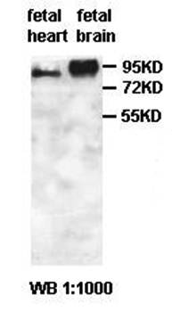 TIGD5 antibody