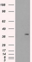 TIGIT antibody