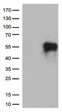 TIM 3 (HAVCR2) antibody
