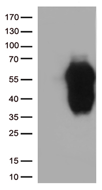 TIM 3 (HAVCR2) antibody