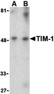 TIM Antibody