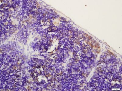 HAVCR2/TIM-3 Rabbit Polyclonal Antibody