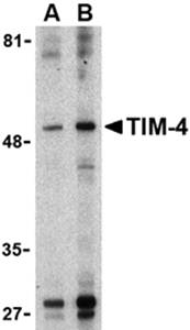 TIM-4 Antibody
